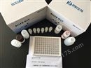 人白细胞介素IL-17AF定量检测elisa试剂盒