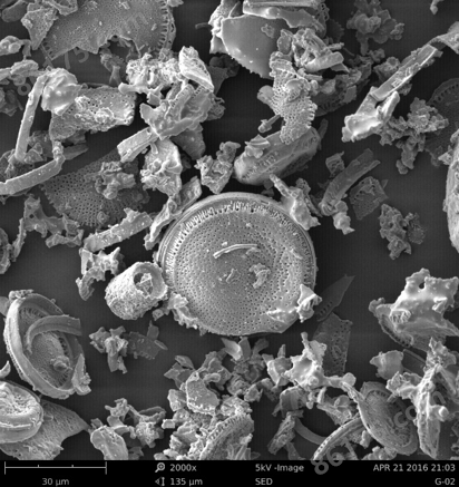 自动硅藻检验 DiatomScopeTM